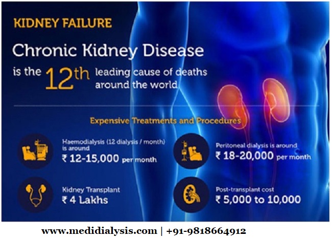 What is the Average Cost of a Dialysis Treatment in India?